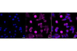 Immunocytochemical staining of HepG2 cells with GABBR1 antibody (ABIN7798690), 1:1,000).