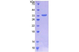 SDS-PAGE (SDS) image for Integrin-Linked Kinase (ILK) (AA 183-452) protein (His tag) (ABIN4988755)