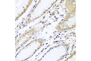 Immunohistochemistry of paraffin-embedded human stomach using WDR48 antibody (ABIN5974731) at dilution of 1/100 (40x lens).