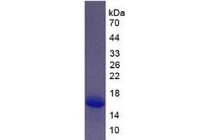 SDS-PAGE of Protein Standard from the Kit  (Highly purified E. (S100A6 ELISA Kit)