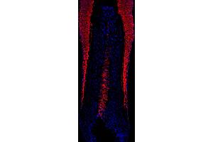 human scalp hair (courtesy of L. (KRT16 antibody)