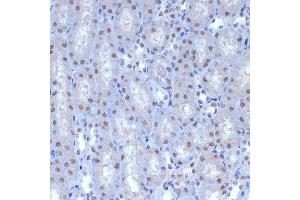 Immunohistochemistry of paraffin-embedded mouse kidney using A Rabbit mAb (ABIN7265387) at dilution of 1:100 (40x lens). (BAF53A antibody)