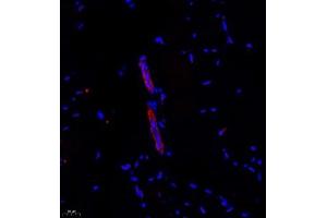 Immunofluorescence of paraffin embedded mouse Skeletal muscle using CITED4 (ABIN7073356) at dilution of 1:2200 (400x lens)