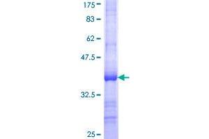 RPL21 Protein (AA 2-85) (GST tag)