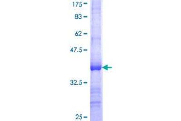 RPL21 Protein (AA 2-85) (GST tag)