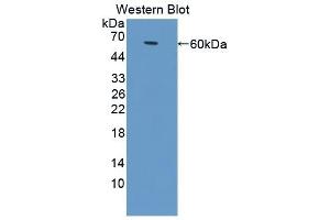 Detection of Recombinant ALCAM, Bovine using Polyclonal Antibody to Activated Leukocyte Cell Adhesion Molecule (ALCAM) (CD166 antibody  (AA 28-527))