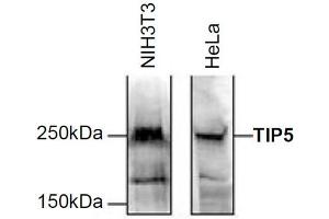 Western Blot of anti-TIP5 antibody Western Blot results of Rabbit anti-TIP5 antibody. (BAZ2A antibody)