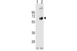 Western blot analysis of FYN antibody and 293 cell lysate (2 ug/lane) either nontransfected (Lane 1) or transiently transfected (2) with the FYN gene.