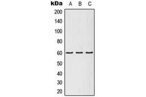 Western blot analysis of TCP1 epsilon expression in A431 (A), Raw264. (CCT5 antibody  (Center))
