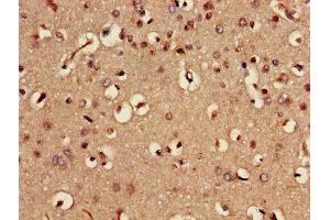 Immunohistochemistry of paraffin-embedded human brain tissue using ABIN7168982 at dilution of 1:100 (STK24 antibody  (AA 1-431))