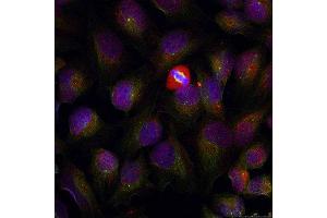 Immunofluorescence (IF) image for anti-Nuclear Factor of kappa Light Polypeptide Gene Enhancer in B-Cells 1 (NFKB1) (pSer337) antibody (ABIN1870464) (NFKB1 antibody  (pSer337))