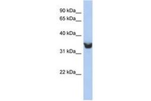 Image no. 1 for anti-delta-Like 1 Homolog (Drosophila) (DLK1) (AA 251-300) antibody (ABIN6743247) (DLK1 antibody  (AA 251-300))