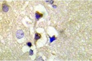 Immunohistochemistry (IHC) analyzes of p-PKD1/PKC-mu antibody in paraffin-embedded human brain tissue. (PKC mu antibody  (pSer910))