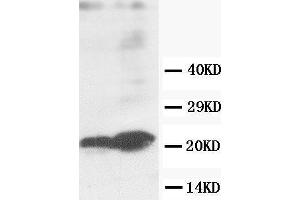 Anti-GST3/GST pi antibody, Western blotting Lane 1: MCF-7 Cell Lysate Lane 2: COLO320 Cell Lysate (GSTP1 antibody  (C-Term))