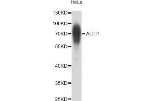 Western blot analysis of extracts of HeLa cells, using ALPP antibody (ABIN2561070) at 1:1000 dilution. (PLAP antibody)
