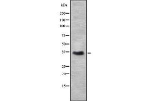 Western blot analysis of DAZL using Jurkat whole cell lysates (DAZL antibody  (Internal Region))