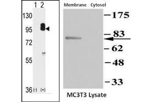 Image no. 1 for anti-Protein Kinase, CGMP-Dependent, Type II (PRKG2) (C-Term) antibody (ABIN360423) (PRKG2 antibody  (C-Term))