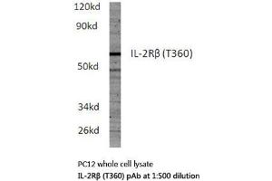 Western blot (WB) analysis of IL-2Rβ antibody in extracts from PC12 cells.