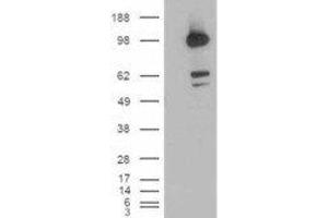 HEK293 overexpressing CDCP1 and probed with ABIN2561770 (mock transfection in first lane). (CDCP1 antibody  (C-Term, Isoform 1))