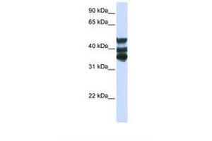 Image no. 1 for anti-Homogentisate 1,2-Dioxygenase (HGD) (AA 252-301) antibody (ABIN6738765) (HGD antibody  (AA 252-301))