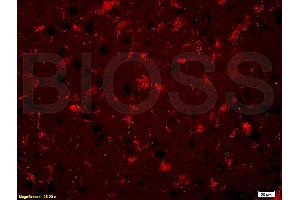 Formalin-fixed and paraffin embedded rat brain labeled with Rabbit Anti BNP Polyclonal Antibody, Unconjugated (ABIN678623) at 1:200 followed by conjugation to the secondary antibody and DAB staining (BNP antibody  (AA 85-115))