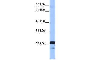 WB Suggested Anti-SFRS9 Antibody Titration: 0. (SFRS9 antibody  (Middle Region))