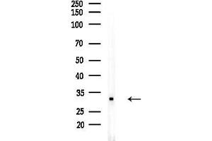 anti-Cyclin B1 Interacting Protein 1 (CCNB1IP1) (Internal Region) antibody