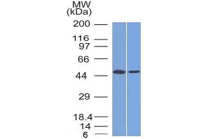 Western Blotting (WB) image for anti-Forkhead Box A1 (FOXA1) (AA 372-472) antibody (ABIN6939651)