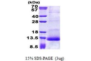 SDS-PAGE (SDS) image for serine Peptidase Inhibitor, Kazal Type 1 (SPINK1) (AA 24-79) protein (His tag) (ABIN5853074) (SPINK1 Protein (AA 24-79) (His tag))