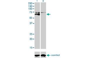 Western blot analysis of ALPL over-expressed 293 cell line, cotransfected with ALPL Validated Chimera RNAi (Lane 2) or non-transfected control (Lane 1). (ALPL antibody  (AA 91-200))