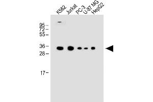 All lanes : Anti-P1R3G Antibody (C-term) at 1:1000 dilution Lane 1: K562 whole cell lysate Lane 2: Jurkat whole cell lysate Lane 3: PC-3 whole cell lysate Lane 4: U-87 MG whole cell lysate Lane 5: HepG2 whole cell lysate Lysates/proteins at 20 μg per lane. (PPP1R3G antibody  (C-Term))
