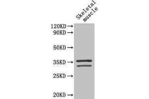 Western Blot Positive WB detected in: Mouse skeletal muscle tissue All lanes: TNNT2 antibody at 4 μg/mL Secondary Goat polyclonal to rabbit IgG at 1/50000 dilution Predicted band size: 36, 35, 32, 31 kDa Observed band size: 36, 32 kDa (Cardiac Troponin T2 antibody  (AA 138-298))