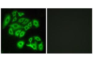 Immunofluorescence analysis of A549 cells, using FZD4 antibody. (FZD4 antibody  (Internal Region))
