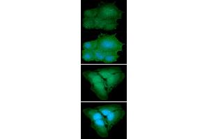 ICC/IF analysis of PARK7 in Hep3B cells line, stained with DAPI (Blue) for nucleus staining and monoclonal anti-human PARK7 antibody (1:100) with goat anti-mouse IgG-Alexa fluor 488 conjugate (Green). (PARK7/DJ1 antibody  (AA 1-189))