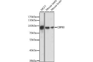 Western blot analysis of extracts of various cell lines, using CBP80 antibody (ABIN6134006, ABIN6138009, ABIN6138010 and ABIN6218117) at 1:1000 dilution. (NCBP1 antibody)