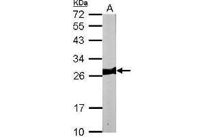 WB Image Sample (50 ug of whole cell lysate) A: mouse heart 12% SDS PAGE antibody diluted at 1:10000 (MYL3/CMLC1 antibody)