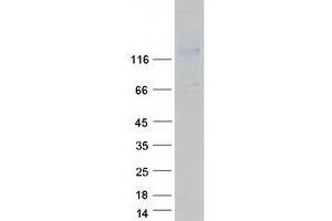 Validation with Western Blot (SEZ6 Protein (Transcript Variant 1) (Myc-DYKDDDDK Tag))