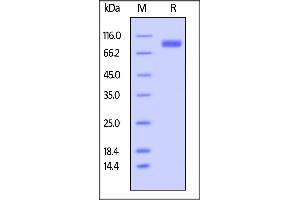 SDS-PAGE (SDS) image for Signal-Regulatory Protein alpha (SIRPA) (AA 31-370) (Active) protein (Fc Tag,AVI tag,Biotin) (ABIN5526677)