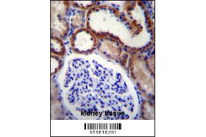 MAP3K15 Antibody immunohistochemistry analysis in formalin fixed and paraffin embedded human kidney tissue followed by peroxidase conjugation of the secondary antibody and DAB staining.