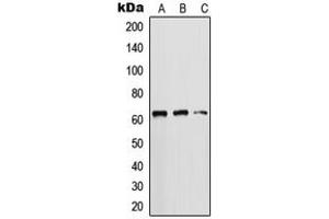 Western blot analysis of Cytokeratin 5 expression in DU145 (A), HeLa (B), MCF7 (C) whole cell lysates. (Cytokeratin 5 antibody  (C-Term))