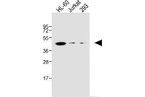 All lanes : Anti-EDG6 Antibody at 1:1000 dilution Lane 1: HL-60 whole cell lysate Lane 2: Jurkat whole cell lysate Lane 3: 293 whole cell lysate Lysates/proteins at 20 μg per lane. (S1PR4 antibody  (N-Term))