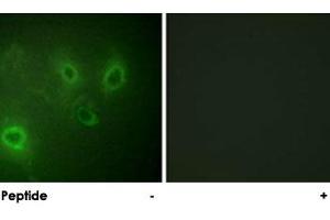 Immunofluorescence analysis of COS-7 cells, using ITPR1 polyclonal antibody . (ITPR1 antibody)