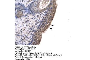 Human Spermatophore (RLIM antibody  (C-Term))