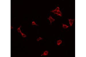 ABIN6269346 staining Hela by IF/ICC. (GRIN2B antibody  (C-Term))