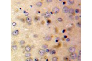 Used in DAB staining on fromalin fixed paraffin-embedded Brain tissue (Afamin antibody  (AA 210-403))