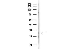 anti-Lecithin Retinol Acyltransferase (Phosphatidylcholine--Retinol O-Acyltransferase) (LRAT) (Internal Region) antibody