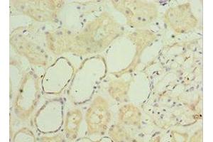 Immunohistochemistry of paraffin-embedded human kidney tissue using ABIN7160782 at dilution of 1:100 (SGSH antibody  (AA 273-502))