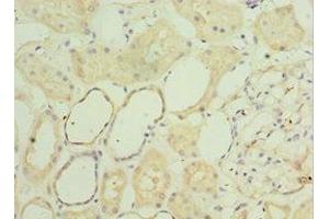 Immunohistochemistry of paraffin-embedded human kidney tissue using ABIN7160782 at dilution of 1:100 (SGSH antibody  (AA 273-502))