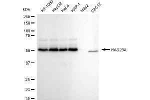 Western blotting analysis using RAD23A antibody (ABIN7800116). (Recombinant RAD23A antibody)