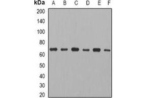 Western blot analysis of CCT3 expression in MCF7 (A), THP1 (B), mouse ovary (C), mouse thymus (D), rat spleen (E), rat heart (F) whole cell lysates.